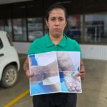 Família aponta negligência de hospital após criança ficar com feridas em braço engessado