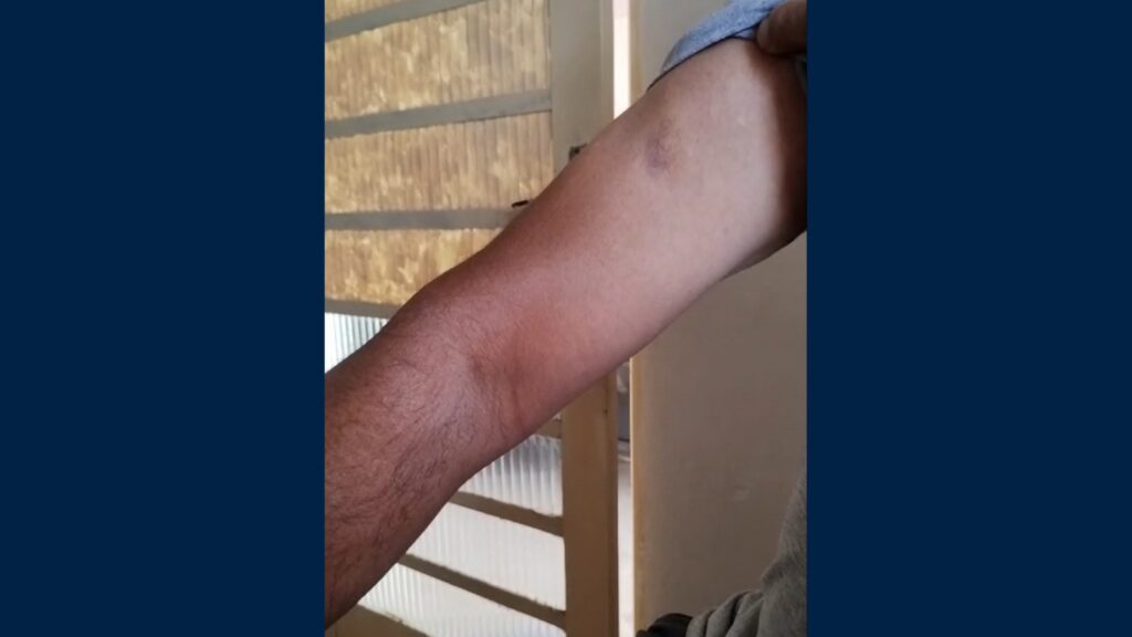 Árbitro registra BO e diz ter sido agredido por prefeito de Estiva em amistoso