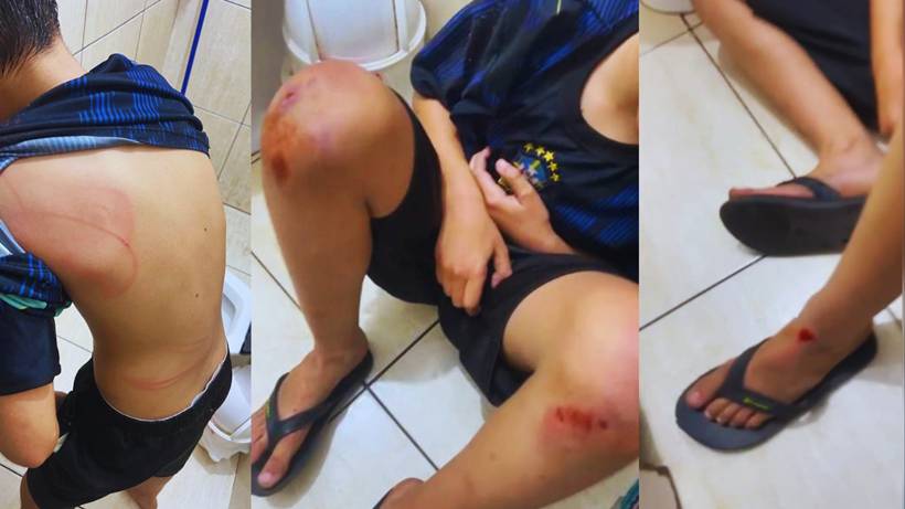 Mãe denuncia que filho autista foi agredido pelo pai e registra BO
