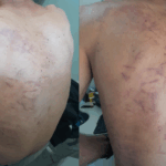 Família de Ouro Fino registra BO e acusa clínica de reabilitação de agredir paciente