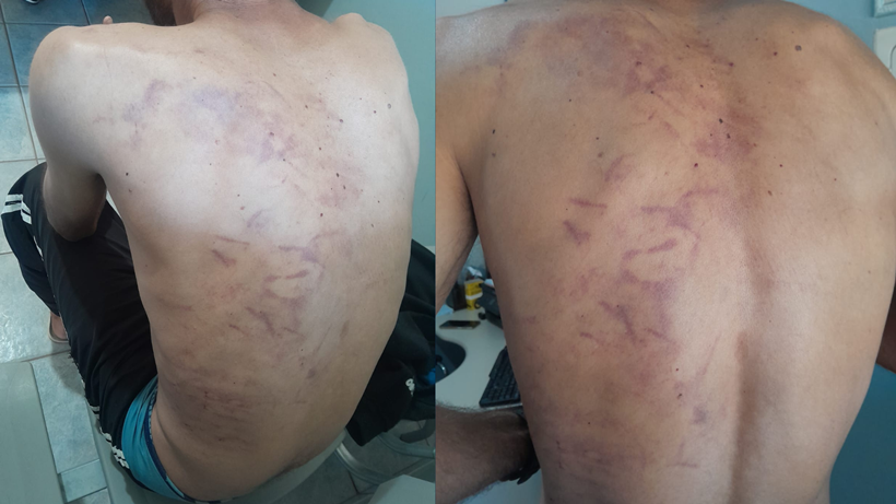 Família de Ouro Fino registra BO e acusa clínica de reabilitação de agredir paciente